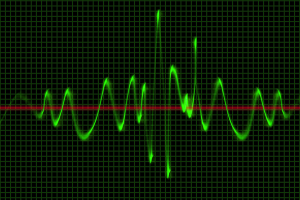 Oscilloscope Screen Readings